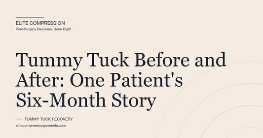 Tummy Tuck Before and After: One Patient's Six-Month Story